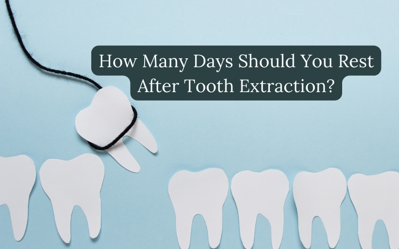 how many days should you rest after tooth extraction
