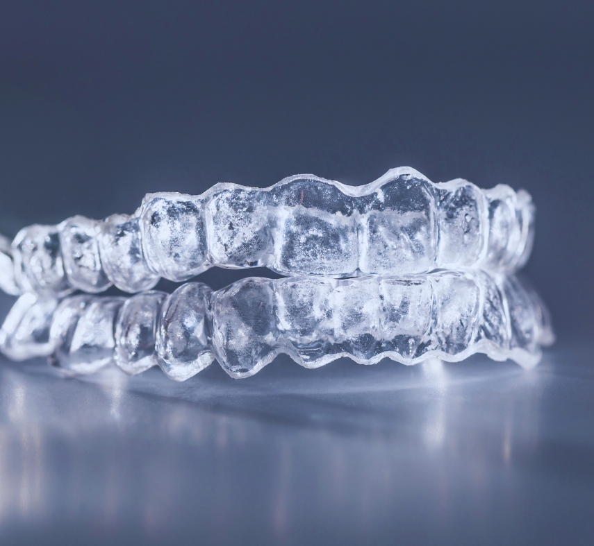 8 Reasons to Choose Clear Aligners Over Metal Braces